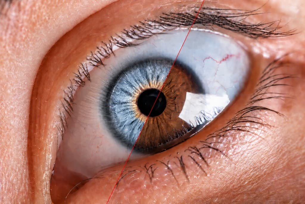 Split iris — KOLOR Congress